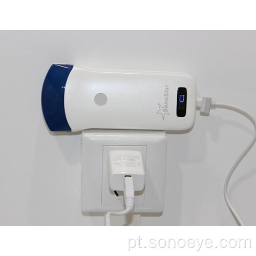 Scanner portátil do ultrassom do mini convexo
